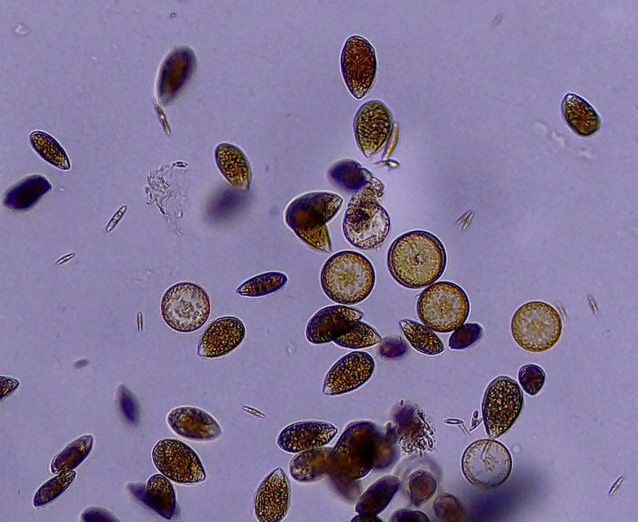 Ostreopsis ovata, la sentinella del Mediterraneo che cambia